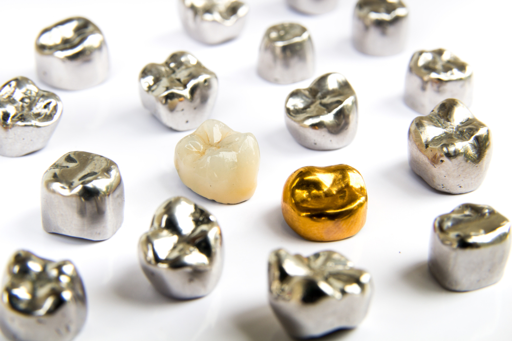 Benefits and Uses of Stainless Steel Crowns