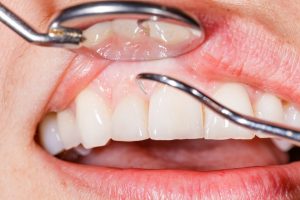 benefits seeing periodontist