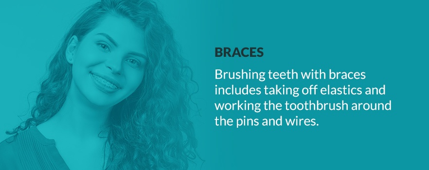 Braces