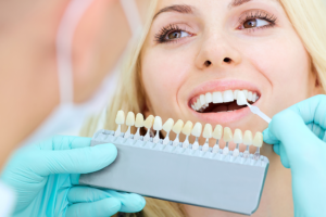 Reasons to Consider Dental Veneers