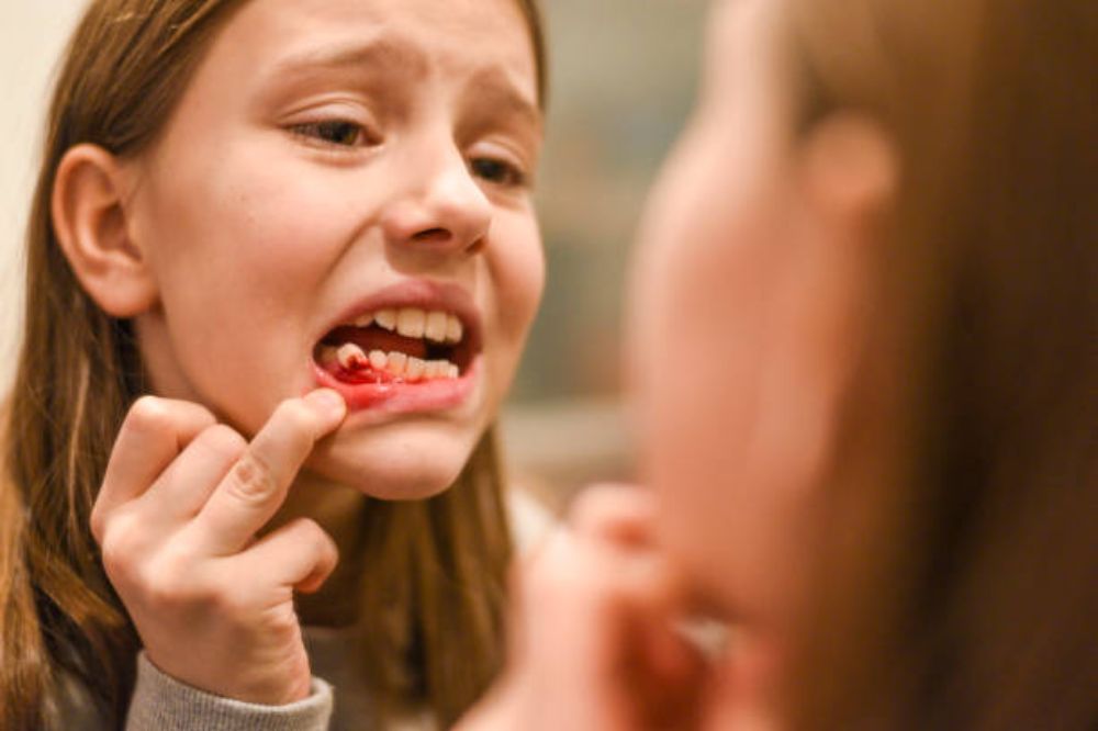 what-causes-bleeding-gums-and-how-can-i-stop-it