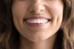 why are straight teeth important beyond appearance
